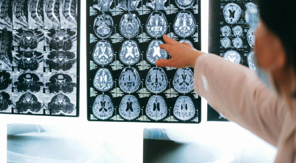 Consumir esta fruta de forma regular puede prevenir problemas de memoria y activar la mente.