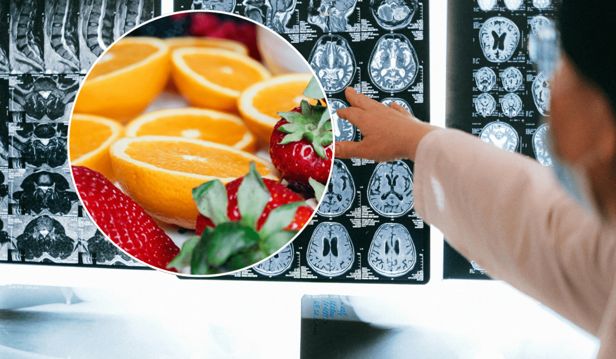 Estos 7 alimentos cuidan tu cerebro y previenen el Alzheimer