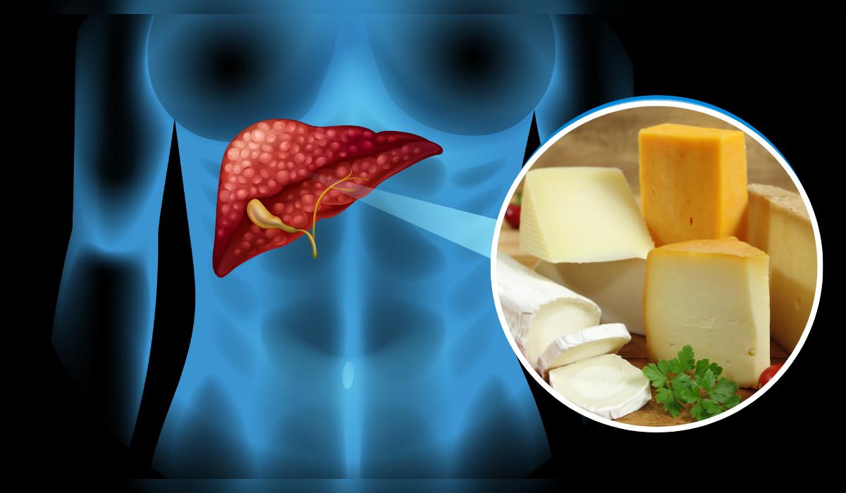 Quesos que no dañan el hígado