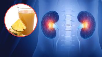 Agua de piña: ¿Qué efecto tiene en los riñones?
