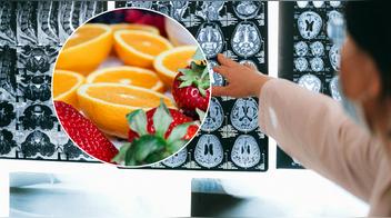Estos 7 alimentos cuidan tu cerebro y previenen el Alzheimer
