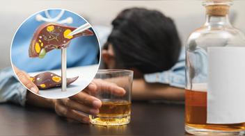 Esto es lo que el alcohol le hace a tu hígado, según la ciencia