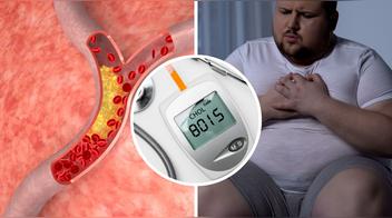 Qué comer para reducir el colesterol malo de forma natural