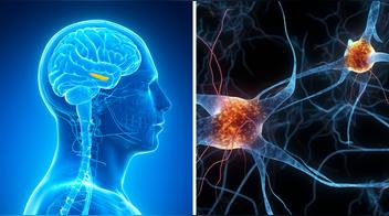 7 alimentos para rejuvenecer tu cerebro