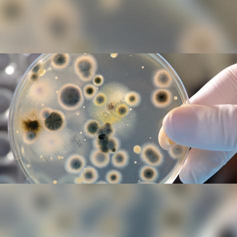 Estos parches eliminar las bacterias de los alimentos. Estos parches eliminar las bacterias de los alimentos.