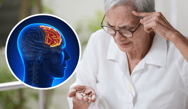 Alzheimer Alzheimer