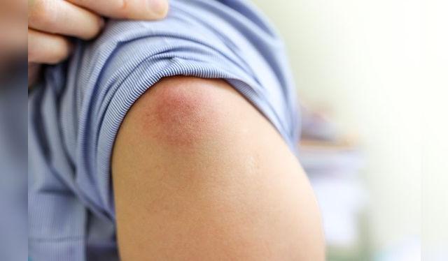 Algunas personas tienen ligeros efectos tras la vacuna.    