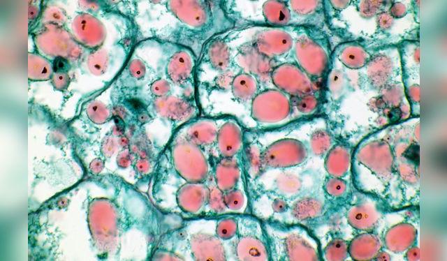 Las moléculas de almidón se abren con el calor y absorben líquido.   