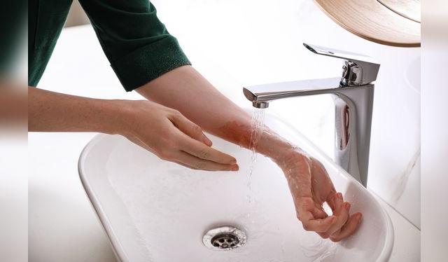 El agua fría es la mejor manera de calmar una quemadura.    