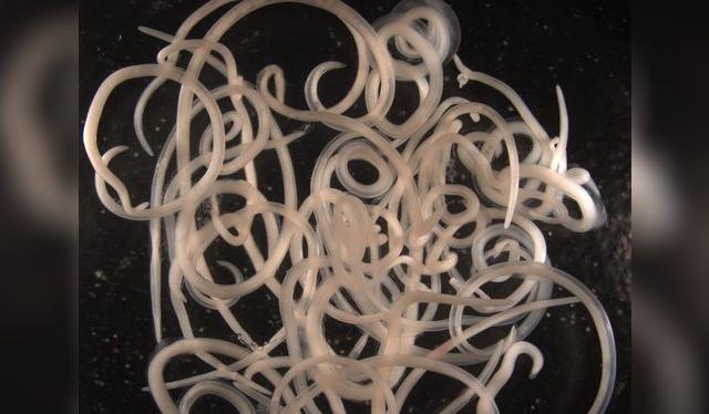 Anisáquidos encontrados en salmón enlatado: parásitos marinos que revelan la salud del océano. Anisáquidos encontrados en salmón enlatado: parásitos marinos que revelan la salud del océano.