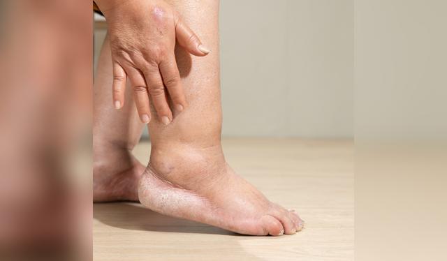 Evitar embutidos, snacks y comida procesada ayuda a reducir el exceso de sodio en la dieta. Evitar embutidos, snacks y comida procesada ayuda a reducir el exceso de sodio en la dieta.