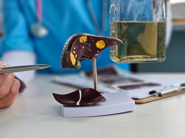 Mantener el hígado sano es crucial para la salud general del organismo. Fuente: Shutterstock.   