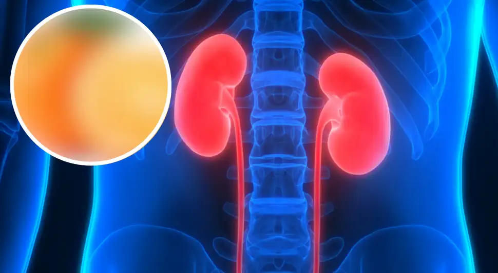 Esta es la fruta que ayuda a mejorar los riñones si la consumes regularmente Esta es la fruta que ayuda a mejorar los riñones si la consumes regularmente