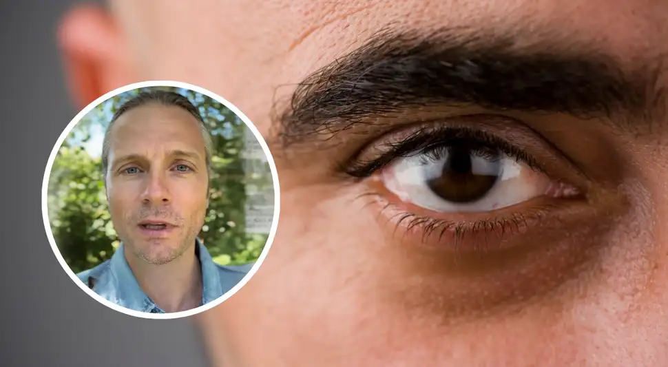 Muchos alimentos afectan la salud de los ojos.