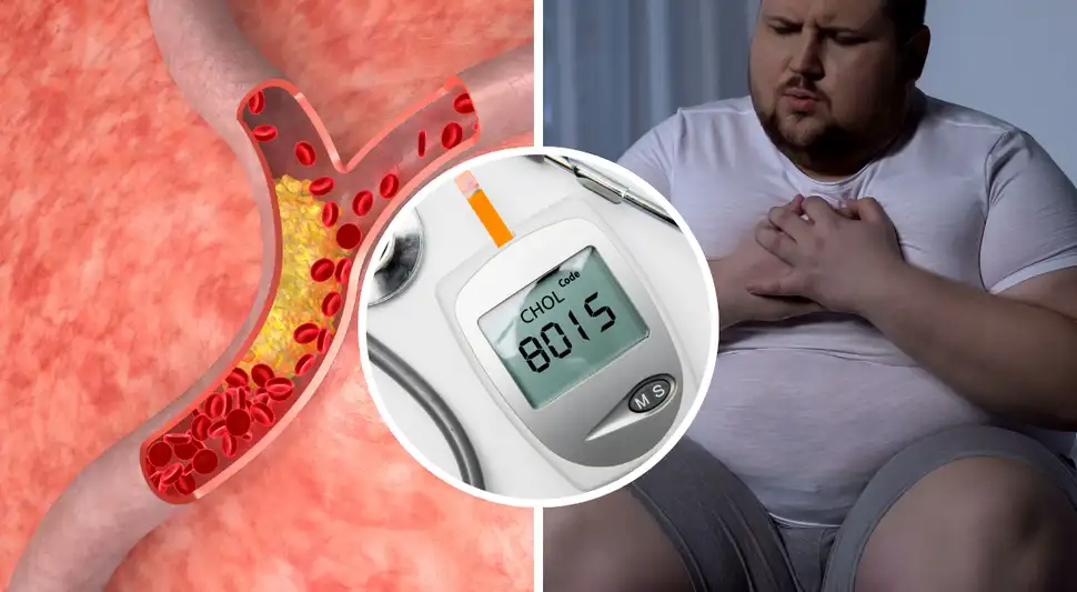 Alimentos que bajan el colesterol malo y cuidan tu corazón